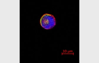 膵癌細胞株（MIAPaca2）a3NaK-ATPaseの免疫染色像