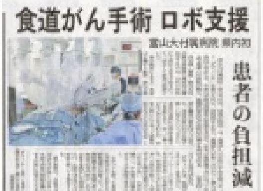 富山大学において富山県で初めて行われたロボット支援下食道がん手術について、北日本新聞に掲載されました。